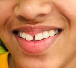Dental treatment