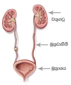 Urinary stones